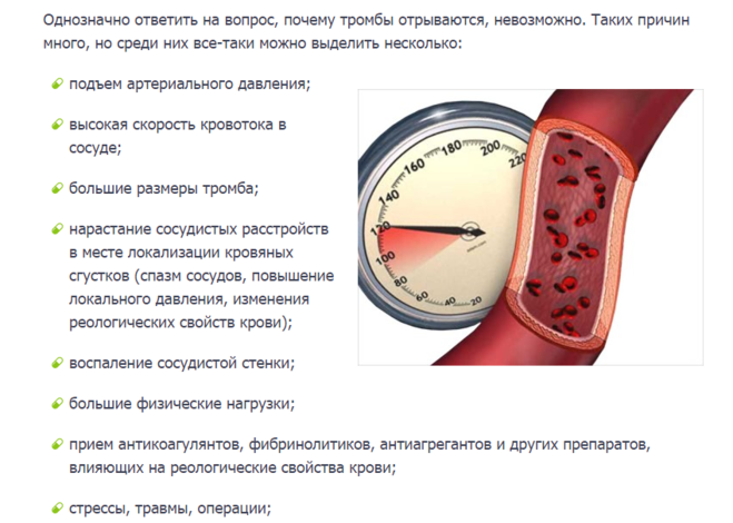 Как отраваеться тромба. Как может оторваться тромб.