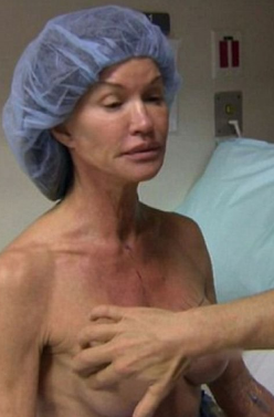 силиконовая грудь у пожилой женщины фото