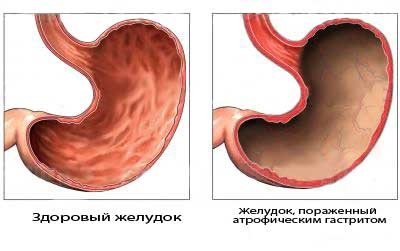 текст при наведении