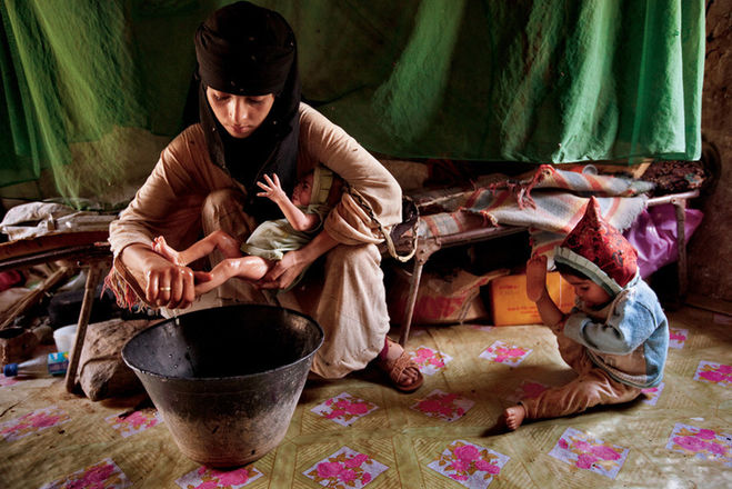 текст при наведении - Йемен, подросток-мать с двумя детьми