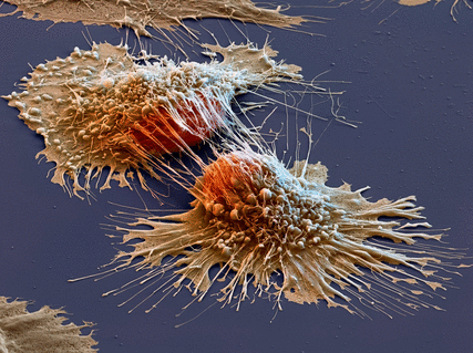 клетки рака