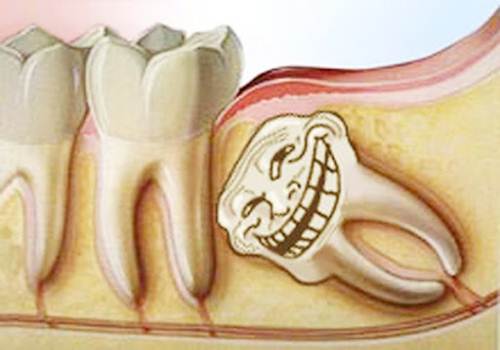 Реально ли вырвать зуб по старинке- ниткой, процесс терпимый?