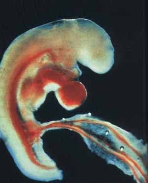 человеческий эмбрион