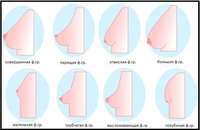 формы груди